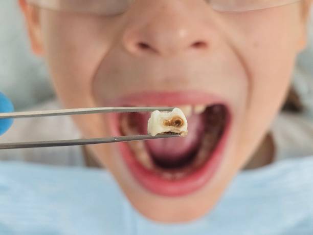 Best Cosmetic Emergency Dentistry in Wildewood, MD