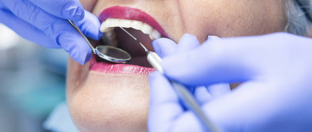 Best Emergency Treatment for Dental Infections or Abscesses in Wildewood, MD